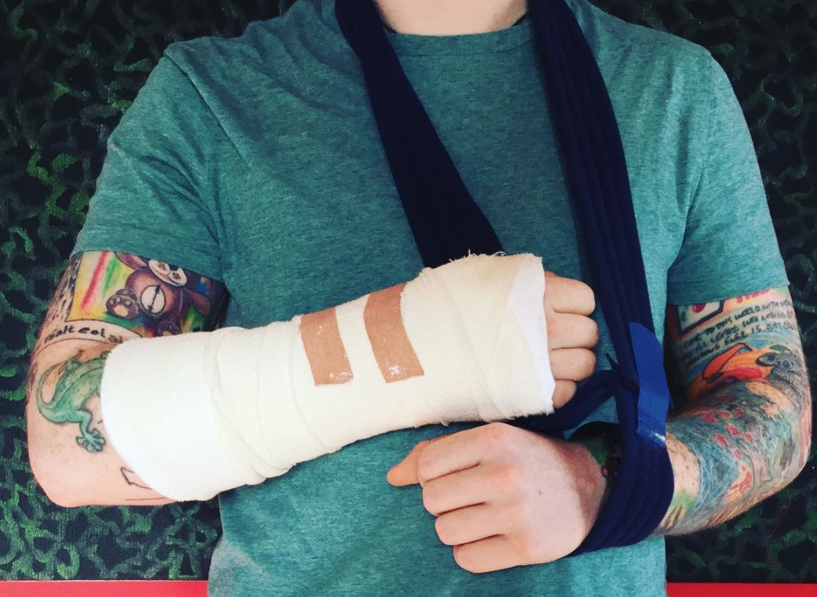 This is How Ed Sheeran’s Bicycle Accident Will Affect His Tour